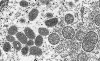 Varíola dos macacos. Cinco perguntas e respostas sobre a doença