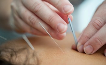 A acupuntura permite fazer terapia de reorientação sexual? Claro que não
