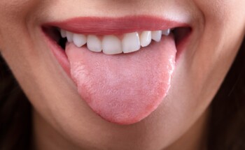 Cor da língua pode indicar problemas de saúde?