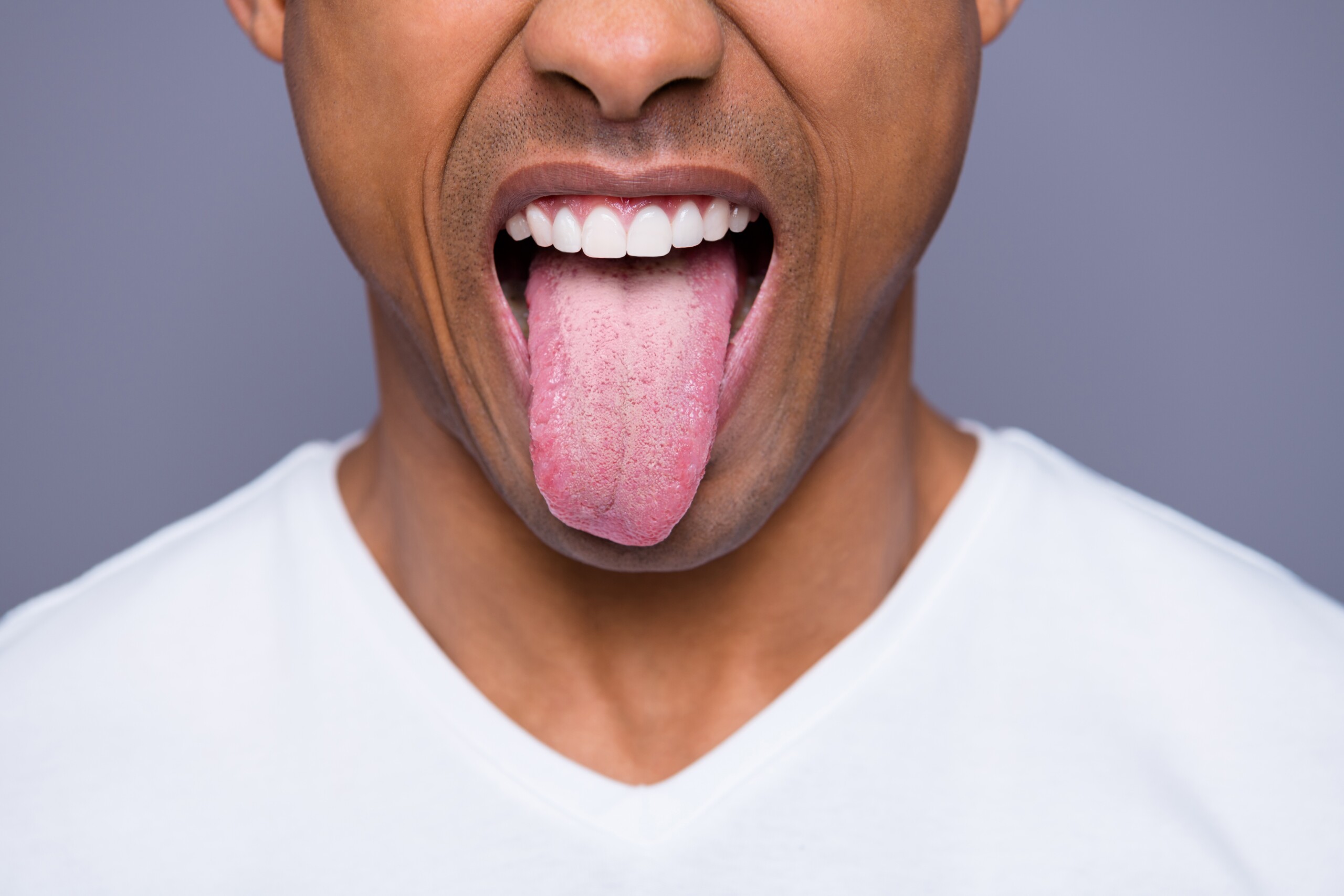 cor da língua