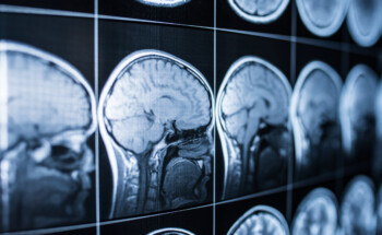 É verdade que usamos só 10% do nosso cérebro?