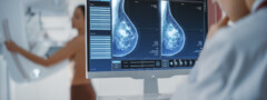 Mamografias são um “crime contra mulheres” porque causam cancro da mama?