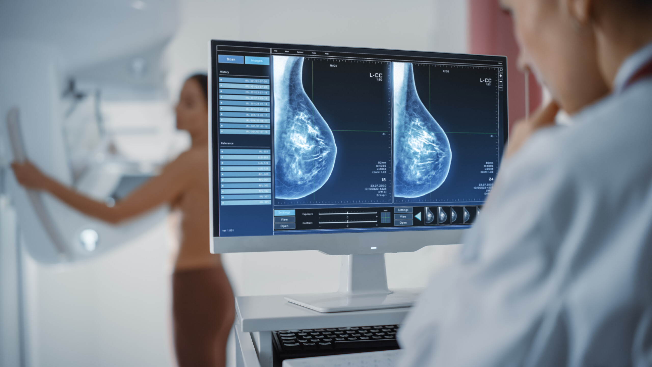 mamografia saúde da mulher rastreios cuidados
